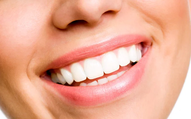 Dental commercial is casting nationwide for those who have had oral surgery