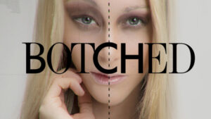 Botched! on E Now Casting in Miami & S. Florida