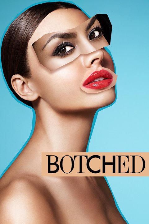 Read more about the article E! “Botched” Now Casting Nationwide