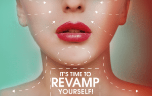 Casting Call for New Plastic Surgery Makeover Show “Revamp”