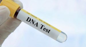 Read more about the article Casting people looking for a DNA test in Los Angeles