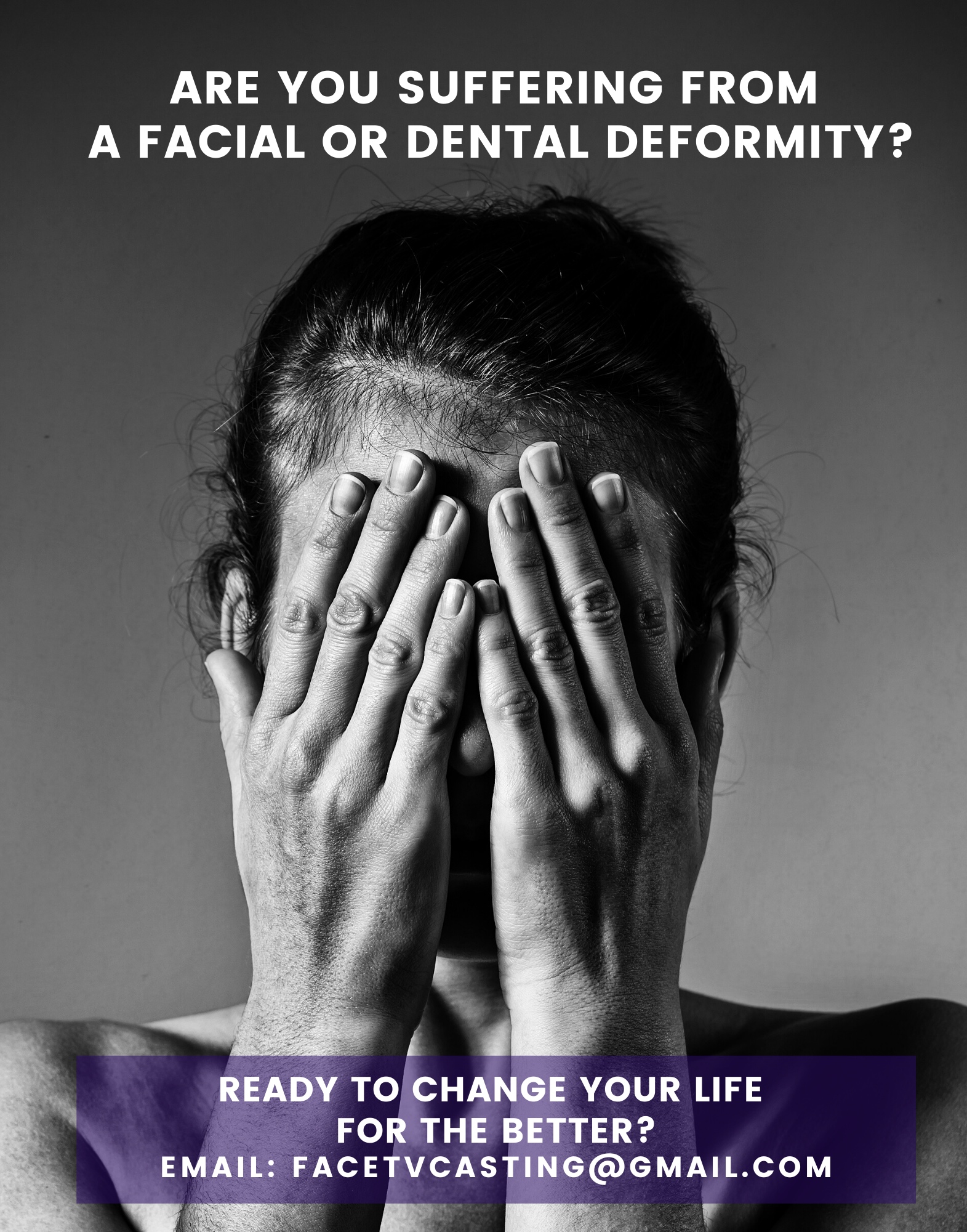 Read more about the article Casting People With Extreme Facial / Dental Conditions Who Need Help