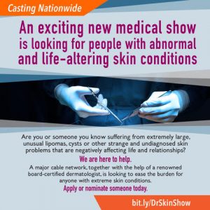 New Dr. Skin Show Casting Call for People With Skin Conditions Needing Help