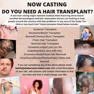 Read more about the article Casting Nationwide for People Who Need a Hair Transplant
