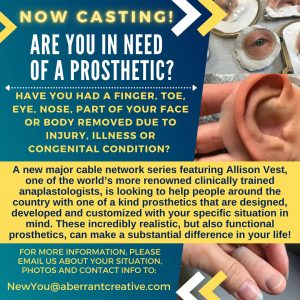 Read more about the article Do You Need A Prosthetic?