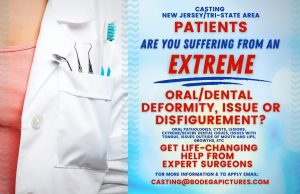 Casting People With Severe Dental Issues in NY / Tri State Area