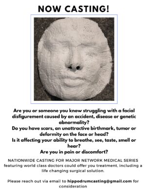 Searching For People With Facial Deformities