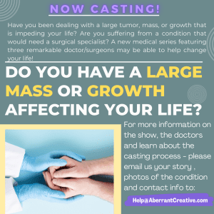Casting People With A Growth Needed to Be Removed