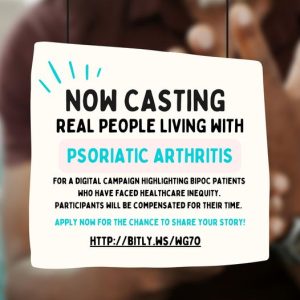 Read more about the article Casting Real People Living With Psoriatic Arthritis