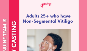 Read more about the article Nationwide Search for People with Non-Segmental Vitiligo